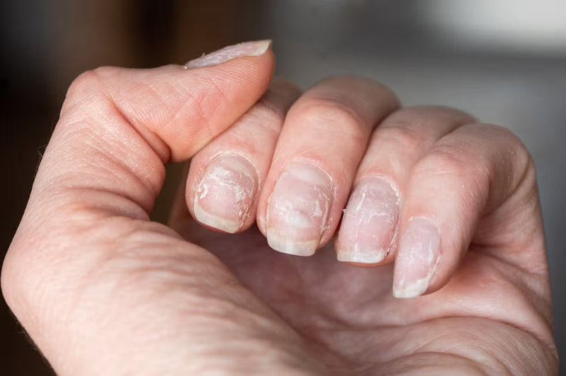 Ongles striés, cassants, dédoublés ou jaunes : causes et solutions pour retrouver des ongles sains et forts
